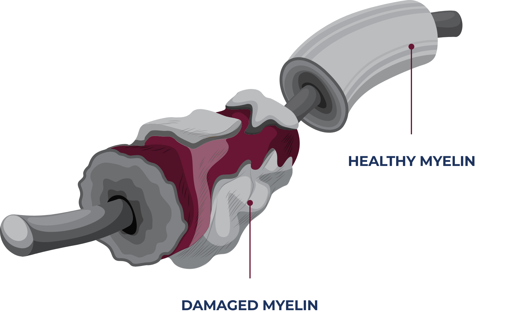 damaged-nervous-system